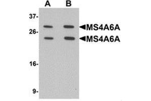 Western blot analysis of MS4A6A in 293 cell lysate with MS4A6A Antibody  at (A) 1 and (B) 2 ug/mL. (MS4A6A antibody  (N-Term))