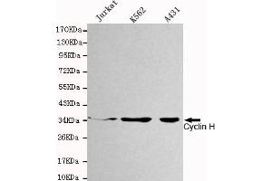 Western blot detection of Cyclin H in Jurkat,K562 and A431 cell lysates using Cyclin H mouse mAb (1:1000 diluted). (Cyclin H antibody)