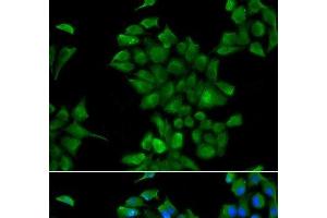 Immunofluorescence analysis of HeLa cells using CTNS Polyclonal Antibody (CTNS antibody)