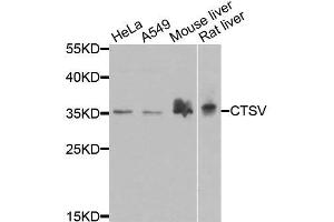 Western blot analysis of extracts of various cell lines, using CTSV antibody. (Cathepsin L2 antibody  (AA 105-334))