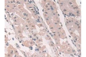 Detection of GCA in Human Stomach Tissue using Polyclonal Antibody to Grancalcin (GCA) (Grancalcin antibody  (AA 1-139))