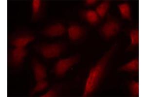 Immunofluorescence staining of methanol-fixed HeLa cells using GATA1 (phospho S310) polyclonal antibody . (GATA1 antibody  (pSer310))
