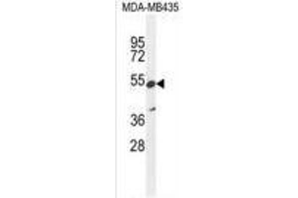 ZNF98 antibody  (C-Term)