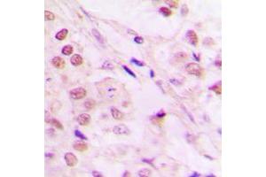 Immunohistochemistry (IHC) image for anti-Transcription Elongation Factor B (SIII), Polypeptide 3 (110kDa, Elongin A) (TCEB3) (Center) antibody (ABIN7299482)
