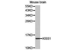 Western Blotting (WB) image for anti-KiSS-1 Metastasis-Suppressor (KISS1) antibody (ABIN1873419) (KISS1 antibody)
