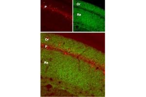 Expression of GluR1 in mouse hippocampus - Immunohistochemical staining of mouse hippocampus with Anti-GluR1 (GluA1) (extracellular) Antibody (ABIN7043226, ABIN7044328 and ABIN7044329). (Glutamate Receptor 1 antibody  (Extracellular))