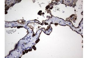Immunohistochemistry (IHC) image for anti-Keratin Acidic (AE1) antibody (ABIN2715666) (Keratin Acidic (AE1) antibody)
