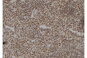ABIN6279487 at 1/100 staining Mouse spleen tissue by IHC-P. (Homeobox A11 antibody)