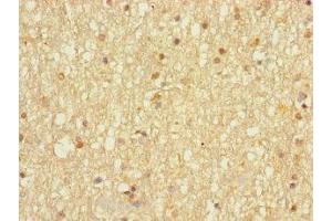 Immunohistochemistry of paraffin-embedded human brain tissue using ABIN7149614 at dilution of 1:100 (DHRS13 antibody  (AA 1-327))
