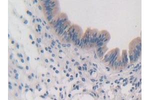 Detection of IPO8 in Mouse Uterus Tissue using Polyclonal Antibody to Importin 8 (IPO8) (Importin 8 antibody  (AA 417-622))