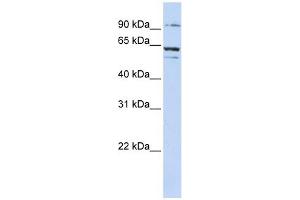 ABCE1 antibody used at 1 ug/ml to detect target protein.