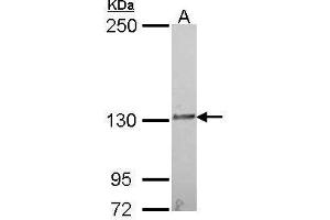 WB Image Sample (30 ug of whole cell lysate) A: A549 5% SDS PAGE IL16 antibody antibody diluted at 1:1000 (IL16 antibody  (C-Term))