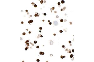 Immunocytochemistry (ICC) image for anti-Myc Tag (AA 410-419) antibody (ABIN7453372) (Recombinant Myc Tag antibody  (AA 410-419))