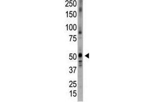 Image no. 1 for anti-Bone Morphogenetic Protein 5 (BMP5) (N-Term) antibody (ABIN357183) (BMP5 antibody  (N-Term))