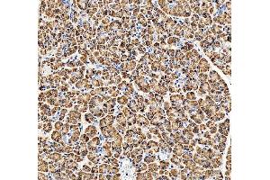 IHC analysis of RPN2 using anti-RPN2 antibody (ABIN7602211). (Ribophorin II antibody  (AA 64-174))
