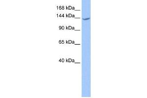 WB Suggested Anti-CACHD1 Antibody Titration:  0.