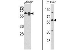 (LEFT) Western blot analysis of MCCC2 Antibody (Center) in CEM, 293 cell line lysates (35ug/lane). (MCCC2 antibody  (Middle Region))