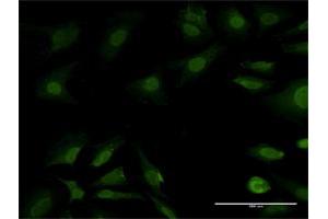 Immunofluorescence of purified MaxPab antibody to PSMB7 on HeLa cell. (PSMB7 antibody  (AA 1-277))