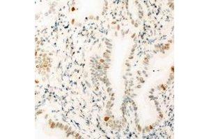 Immunohistochemical analysis of THOC1 staining in mouse kidney formalin fixed paraffin embedded tissue section. (THOC1 antibody)