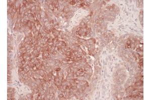 anti-Der1-Like Domain Family, Member 1 (DERL1) (AA 201-251) antibody