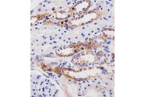 (ABIN6244111 and ABIN6577256) staining ME2 in human kidney tissue sections by Immunohistochemistry (IHC-P - paraformaldehyde-fixed, paraffin-embedded sections). (NAD-ME antibody  (C-Term))