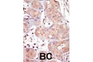 Immunohistochemistry (IHC) image for anti-Male Germ Cell-Associated Kinase (MAK) antibody (ABIN3003276) (MAK antibody)