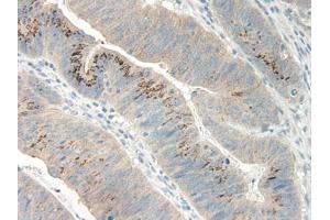 Image no. 1 for anti-Growth Regulated Oncogene gamma (GRO gamma) antibody (ABIN465908) (GRO gamma antibody)