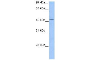 HMBS antibody used at 1 ug/ml to detect target protein. (HMBS antibody  (Middle Region))