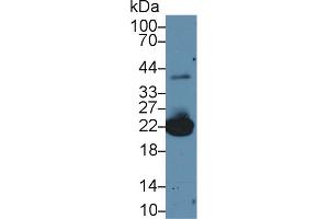 Western Blot; Sample: Mouse Liver lysate; Primary Ab: 2µg/ml Rabbit Anti-Mouse PRDX1 Antibody Second Ab: 0.