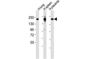 Western blot testing of MRC1L1 antibody at 1:2000 dilution and human samples: Lane 1: lung lysate (Macrophage Mannose Receptor 1 antibody  (AA 359-388))
