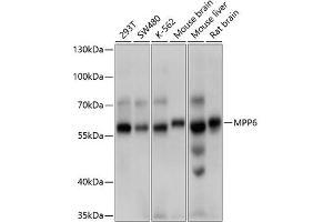 Western blot analysis of extracts of various cell lines, using MPP6 antibody (ABIN6132328, ABIN6143972, ABIN6143973 and ABIN6214790) at 1:1000 dilution. (MPP6 antibody  (AA 220-420))