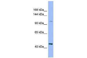 XYLT2 antibody used at 1 ug/ml to detect target protein. (XYLT2 antibody  (Middle Region))