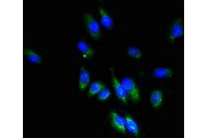 Immunofluorescent analysis of Hela cells using ABIN7171842 at dilution of 1:100 and Alexa Fluor 488-congugated AffiniPure Goat Anti-Rabbit IgG(H+L) (TSPAN1 antibody  (AA 110-211))