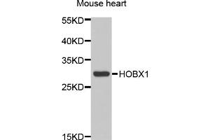 Western blot analysis of extracts of mouse heart, using HOXB1 antibody (ABIN5973981) at 1/1000 dilution. (HOXB1 antibody)