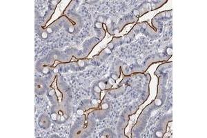 Immunohistochemical staining of human duodenum with MYO7B polyclonal antibody  shows strong membranous positivity in glandular cells at 1:20-1:50 dilution.