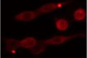 ABIN6274280 staining Hela cells by IF/ICC. (DGKE antibody  (Internal Region))