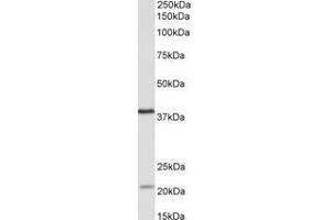 Image no. 1 for anti-Kelch Domain Containing 8B (KLHDC8B) (AA 259-270) antibody (ABIN1102756) (KLHDC8B antibody  (AA 259-270))