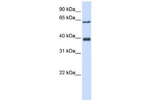 IKZF3 antibody used at 0. (IKZF3 antibody  (C-Term))