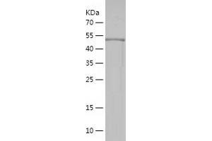 TNRC5 Protein (AA 31-278) (His-IF2DI Tag)