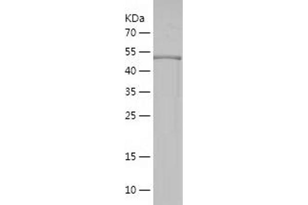 TNRC5 Protein (AA 31-278) (His-IF2DI Tag)