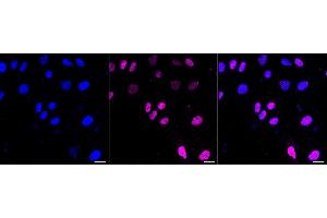 Immunocytochemical staining of H9c2 cells with MEF2A+MEF2C antibody (ABIN7799353), 1:1,000).