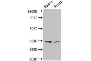 Western Blot Positive WB detected in: Mouse heart tissue, Mouse brain tissue All lanes: CDK5 antibody at 4 μg/mL Secondary Goat polyclonal to rabbit IgG at 1/50000 dilution Predicted band size: 34, 30 kDa Observed band size: 34 kDa (CDK5 antibody  (AA 1-292))