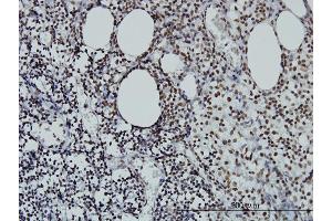 Immunoperoxidase of monoclonal antibody to STAG2 on formalin-fixed paraffin-embedded human lymph node. (STAG2 antibody  (AA 1130-1231))