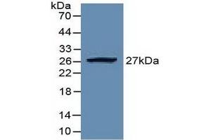 EZH2 Antikörper  (AA 51-285)