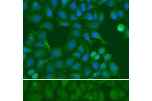 Immunofluorescence analysis of A549 cells using SSX5 Polyclonal Antibody (SSX5 antibody)