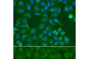 Immunofluorescence analysis of A549 cells using SSX5 Polyclonal Antibody