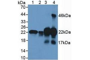 Figure. (CSRP1 antibody  (AA 1-193))