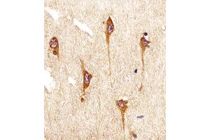 (ABIN6242493 and ABIN6577096) staining NTRK2 in human brain sections by Immunohistochemistry (IHC-P - paraformaldehyde-fixed, paraffin-embedded sections). (TRKB antibody)