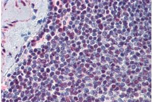 Human Spleen: Formalin-Fixed, Paraffin-Embedded (FFPE) (p300 antibody  (AA 731-831))