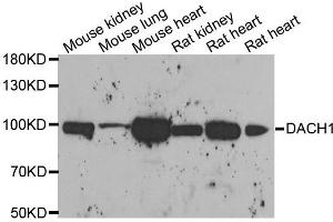 Western blot analysis of extracts of various cell lines, using DACH1 antibody. (DACH1 antibody)